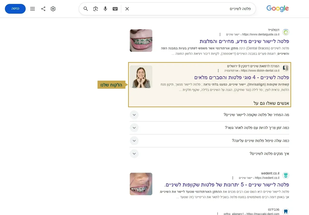 קידום מרפאה בגוגל, מקום שני על החיפוש פלטה לשיניים