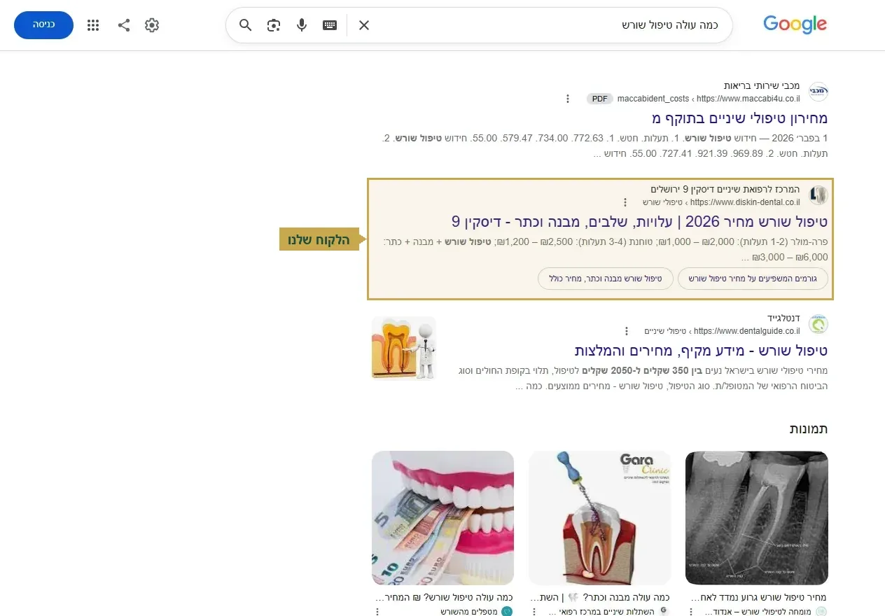 קידום אתרים למרפאות, מרפאה פרטית מעל קופת חולים על כמה עולה טיפול שורש