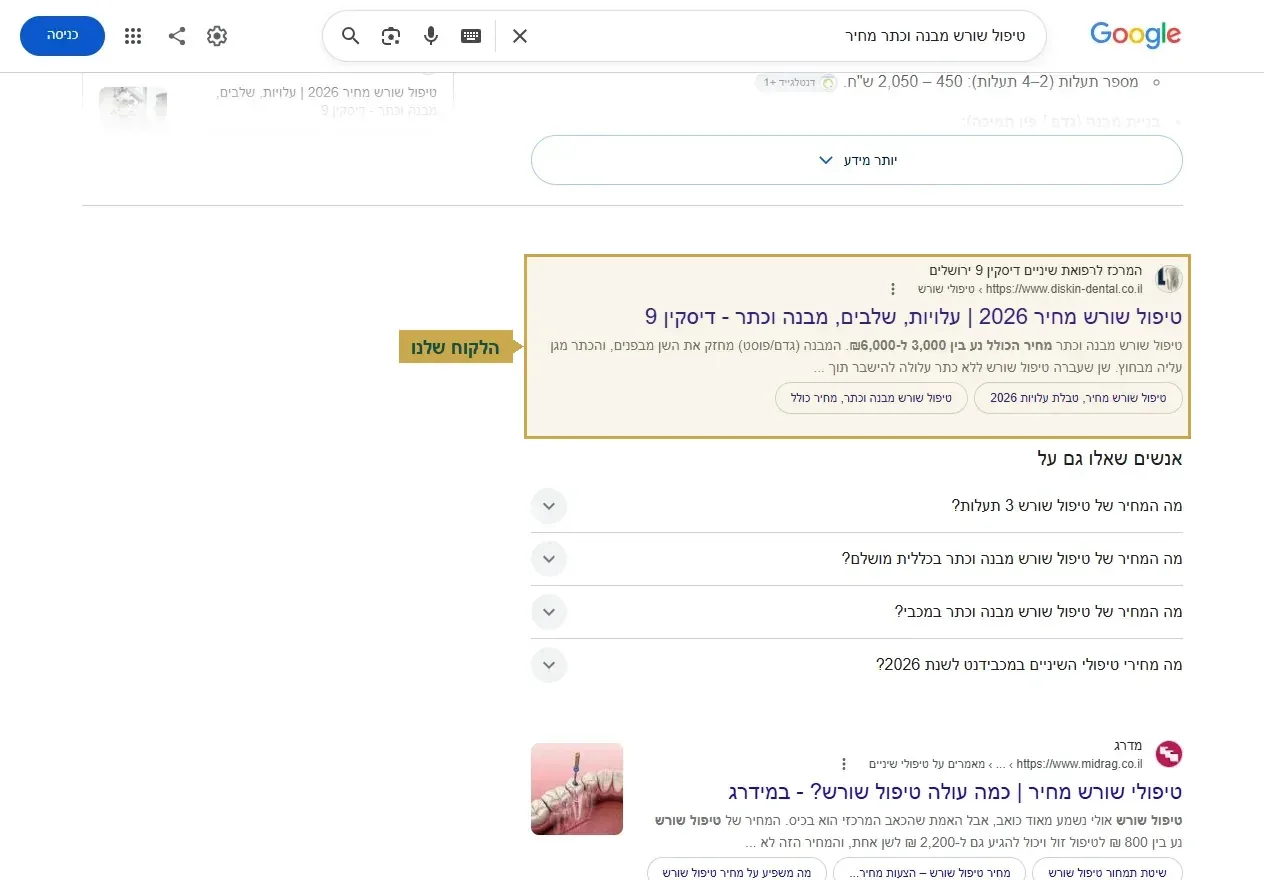 קידום אתר רופא, מקום ראשון על טיפול שורש מבנה וכתר מחיר