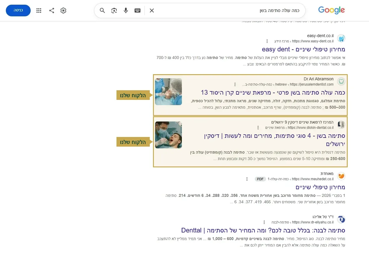 קידום אתרים לרופאים, שתי מרפאות שלנו זו אחרי זו על כמה עולה סתימה בשן