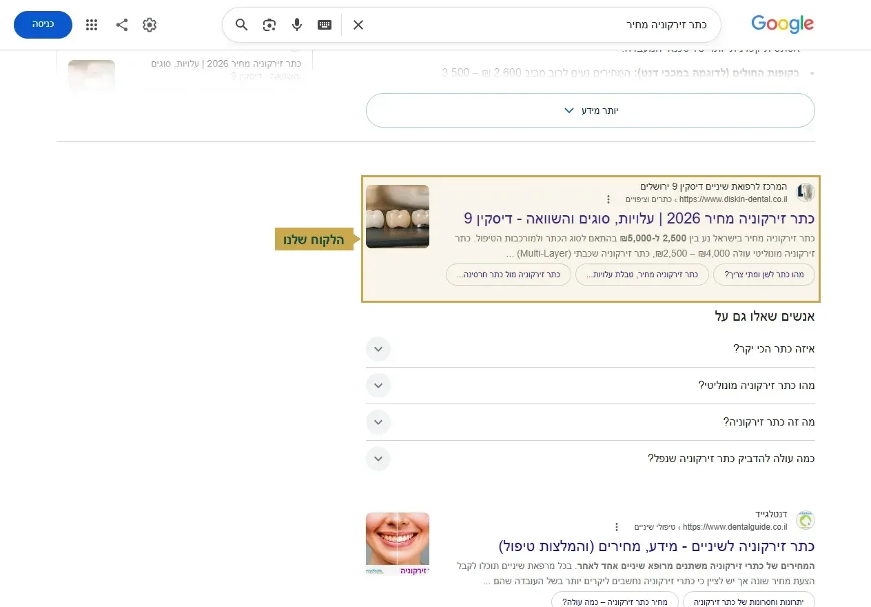 קידום רופאים באינטרנט, מקום ראשון על החיפוש כתר זירקוניה מחיר